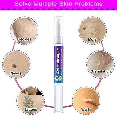 Warts & Moles Remover Pen (14 Days Money Back Guarantee) - My Store