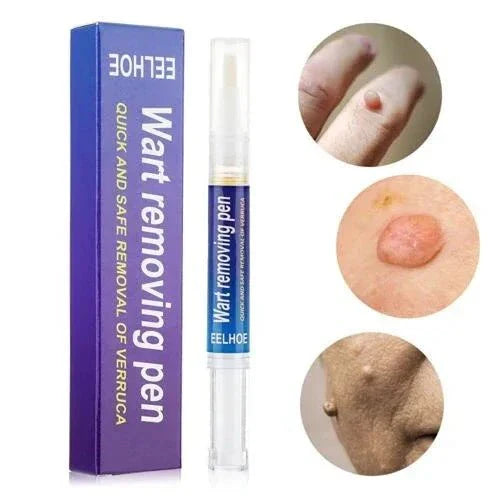Warts & Moles Remover Pen (14 Days Money Back Guarantee) - My Store